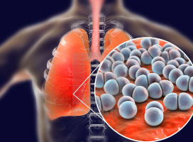 第四代ALK抑制剂现身 破解肺癌“钻石”突变耐药难题