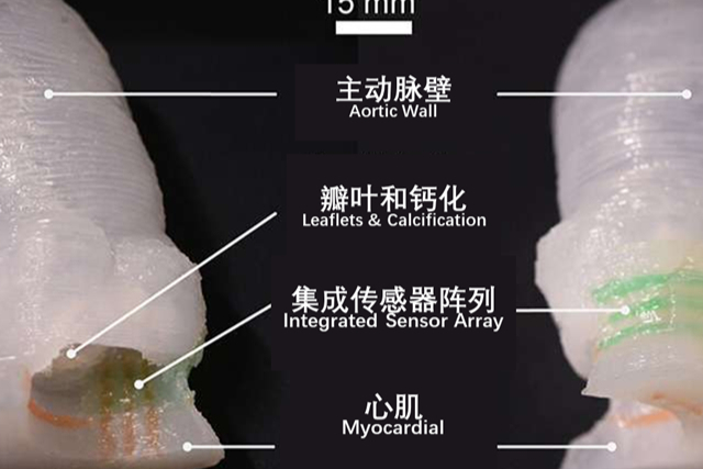 3D打印|研究人员打印出高仿真心脏瓣膜模型